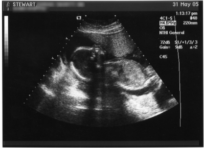 My wee one.